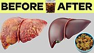 How to Make Raisin Water and Clean the Liver in Just 4 days