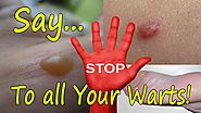 Warts, and how to remove them (Wartrol Review)