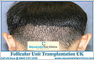 Switch To Affordable Follicular Unit Transplantation UK Agency For Healthy hairs - Rejuvenate Hair Clinics