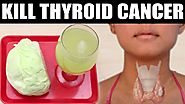 No Need to Worry About Thyroid Cancer || Kill Thyroid Cancer