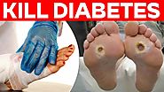 Diabetes overview: Causes, symptoms, treatment
