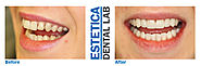 Dental Laboratory London | Clinical Dental Technicians – Estetica Dental Lab, London, UK