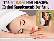 Natural Supplements Pills to Get Rid of Pimples Scars, Acne Treatments