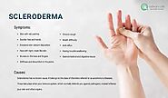 Scleroderma Symptoms, Types, and Available Treatment