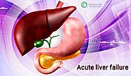 Acute Liver Injury Symptoms
