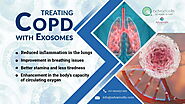 Exosomes For COPD and Lung Disease | Advancells