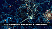 Facts Of Parkinson’s Disease And Stem Cell Therapy | Advancells