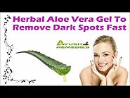 Herbal Aloe Vera Gel To Remove Dark Spots Fast