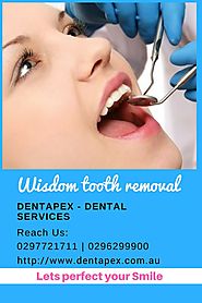 Wisdom tooth removal at Padstow and Stanhope Gardens (NSW)