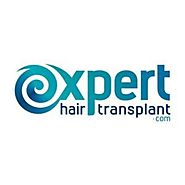 Greffe Cheveux Femme Turquie, Transplantation de cheveux, Aperçu de la Perte de Cheveux