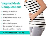 Top Vaginal Implant Complications Associated With TVM