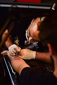Tattoo Removal Laser Machines – Georgy H. – Medium