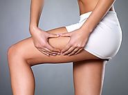 The 5 Best Cellulite Reduction Methods for Men and Women of All Ages