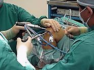 Acl Ligament Surgery Cost in Chennai
