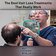 Hair Transplant Network — The Best Hair Loss Treatments That Really Work
