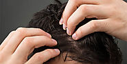 Virginia Surgical Hair Center - Richmond Surgical Arts