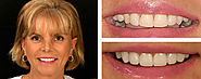 Cosmetic Dentist Sarasota - Dr. Jenifer C. Back