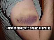 Home Remedies To Get Rid Of Bruise Faster - Bruise Treatment