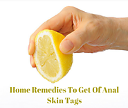 Top 8 Home Remedies For Anal Skin Tags Removal