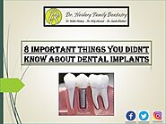 8 Critical Things You May Not Know About Dental Implants
