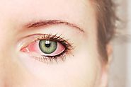 Eye Allergies or Dry Eye Syndrome? A Visit to Your Eye Clinic Can Clear Things Up