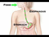 Understanding Acid Reflux Disease (Health Tip)