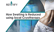 How Swelling is Reduced Using Local Cryotherapy