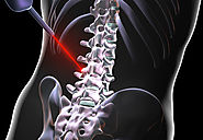 Most Common Reasons that can Lead to Spinal Pain