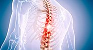 Find the Right Spine Surgeon in the US Virgin Islands