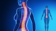 What to Do When You Need a Spinal Fusion Surgery