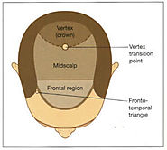 Hair Transplant Treatment | Hair Transplant Doctor and Specialist