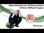 Natural Herbal Cure of External Piles at Home without Surgery