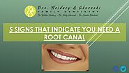 5 Signs that Indicate You need a Root Canal