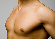 Male Breast Reduction | Gynecomastia in Punjab, India