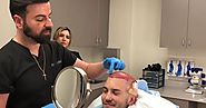 FUE Hair Transplant Surgery – Everything You Need to Know?