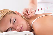 Things to Know about the Acupuncture and Its Benefits