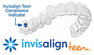 How Invisalign Works