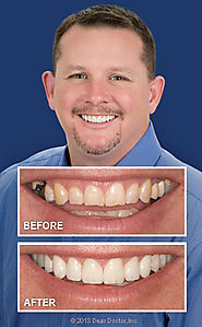 Advanced Dentistry – The best way to fix the dental troubles