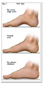 Treatment for Foot Problems in Augusta, GA