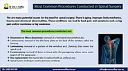 Most Common Procedures Conducted in Spinal Surgery - Orthopaedic Surgeon