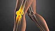 Dr. Expert for Total Knee Replacement, Knee Surgery, Knee Arthroscopy