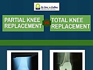 Partial Knee Replacement VS Total Knee Replacement