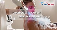 Cryotherapy Treatment - What Really works