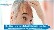 Rejuvenate Hair Clinics — Best biofibre hair transplant London