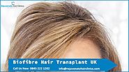 Best Biofibre hair transplant clinics in UK - Rejuvenate Hair Clinics
