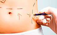 Get Tummy Tuck Surgery in Vancouver