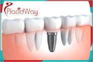 World Class Dental Implants in India