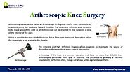 Get Treatment of Knee Surgery through Arthroscopy