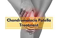 How To Treat Chondromalacia Naturally- Chondromalacia Patella Exercises