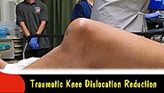 Traumatic Knee Dislocation Reduction-Quick Version
